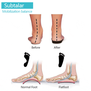 Elastic toe separator, 1 pair